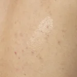 The Ordinary Salicylic Acid 0.5% Body Serum - Image 3