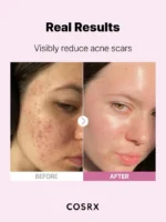 Cosrx The Niacinamide 15 Serum - Image 8