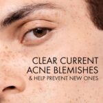 Vichy Normaderm PhytoAction Salicylic Acid Gel Cleanser - Image 4